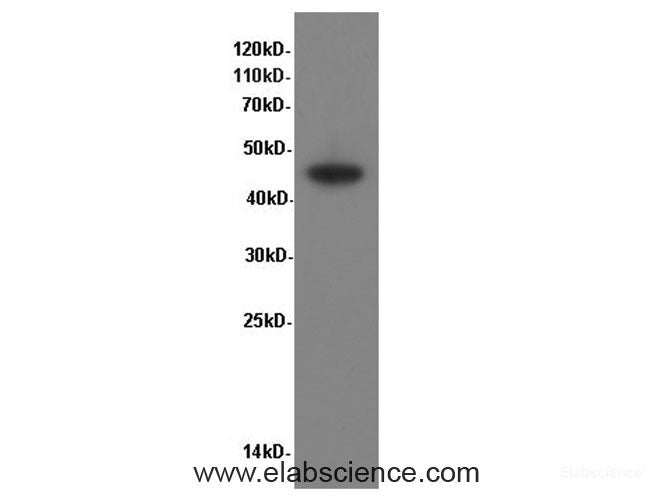 Western Blot analysis of Caco-2 cells using CK-20 Polyclonal Antibody at dilution of 1:600