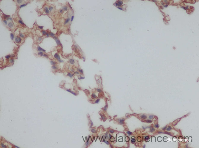 Immunohistochemistry of paraffin-embedded Rat lung using IL10 Polyclonal Antibody at dilution of 1:50