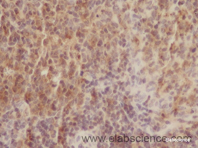 Immunohistochemistry of paraffin-embedded Rat spleen using CD3E Polyclonal Antibody at dilution of 1:50
