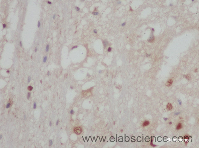 Immunohistochemistry of paraffin-embedded Rat brain using STAT2 Polyclonal Antibody at dilution of 1:50