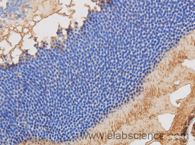 Immunohistochemistry of paraffin-embedded Mouse retina using RBP3 Polyclonal Antibody at dilution of 1:50