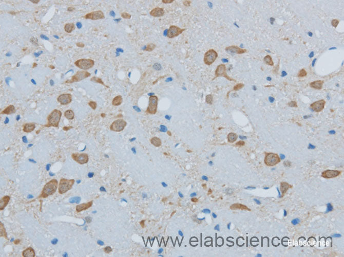 Immunohistochemistry of paraffin-embedded Mouse brain using TIMP4 Polyclonal Antibody at dilution of 1:50