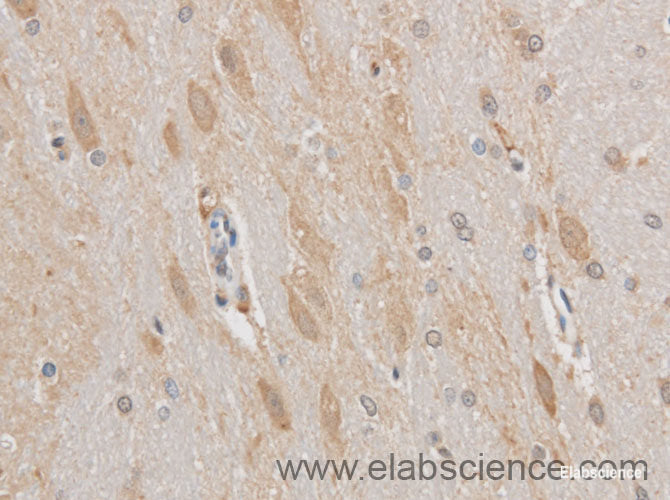 Immunohistochemistry of paraffin-embedded Mouse brain using MAP2 Polyclonal Antibody at dilution of 1:50
