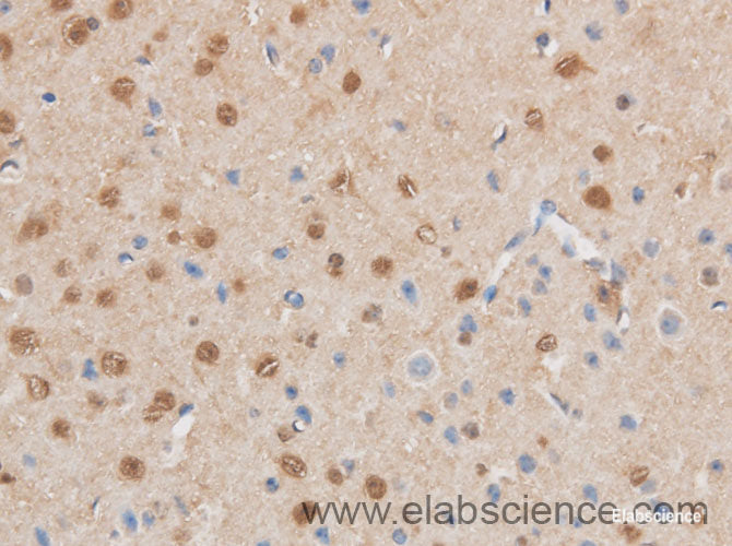 Immunohistochemistry of paraffin-embedded Mouse brain using MAP2K6 Polyclonal Antibody at dilution of 1:50