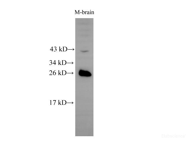 Western Blot analysis of Mouse brain tissue using RAB5B Polyclonal Antibody at dilution of 1:500