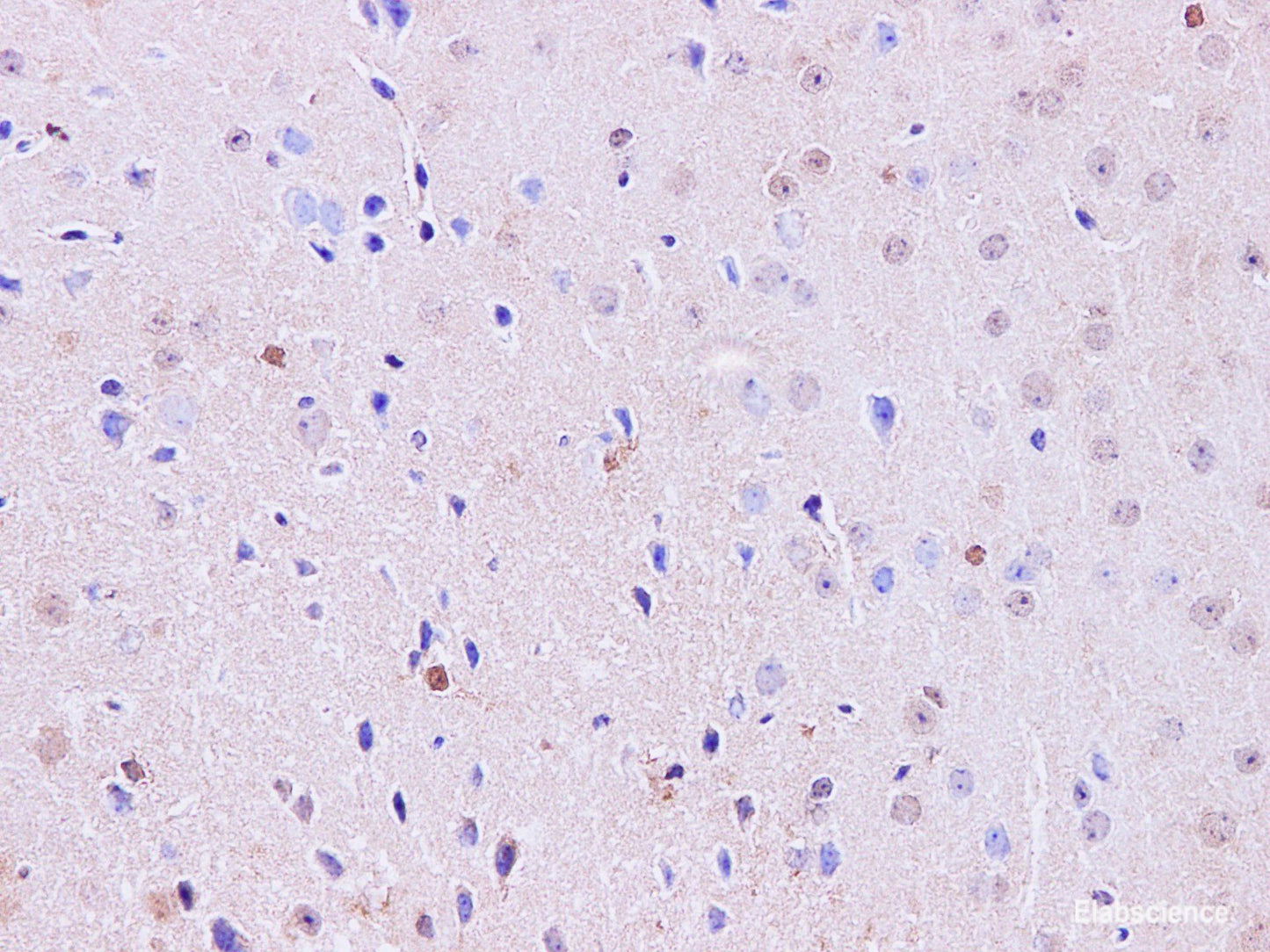 Immunohistochemistry of paraffin-embedded Mouse brain using Hoxa1 Polyclonal Antibody at dilution of 1:100