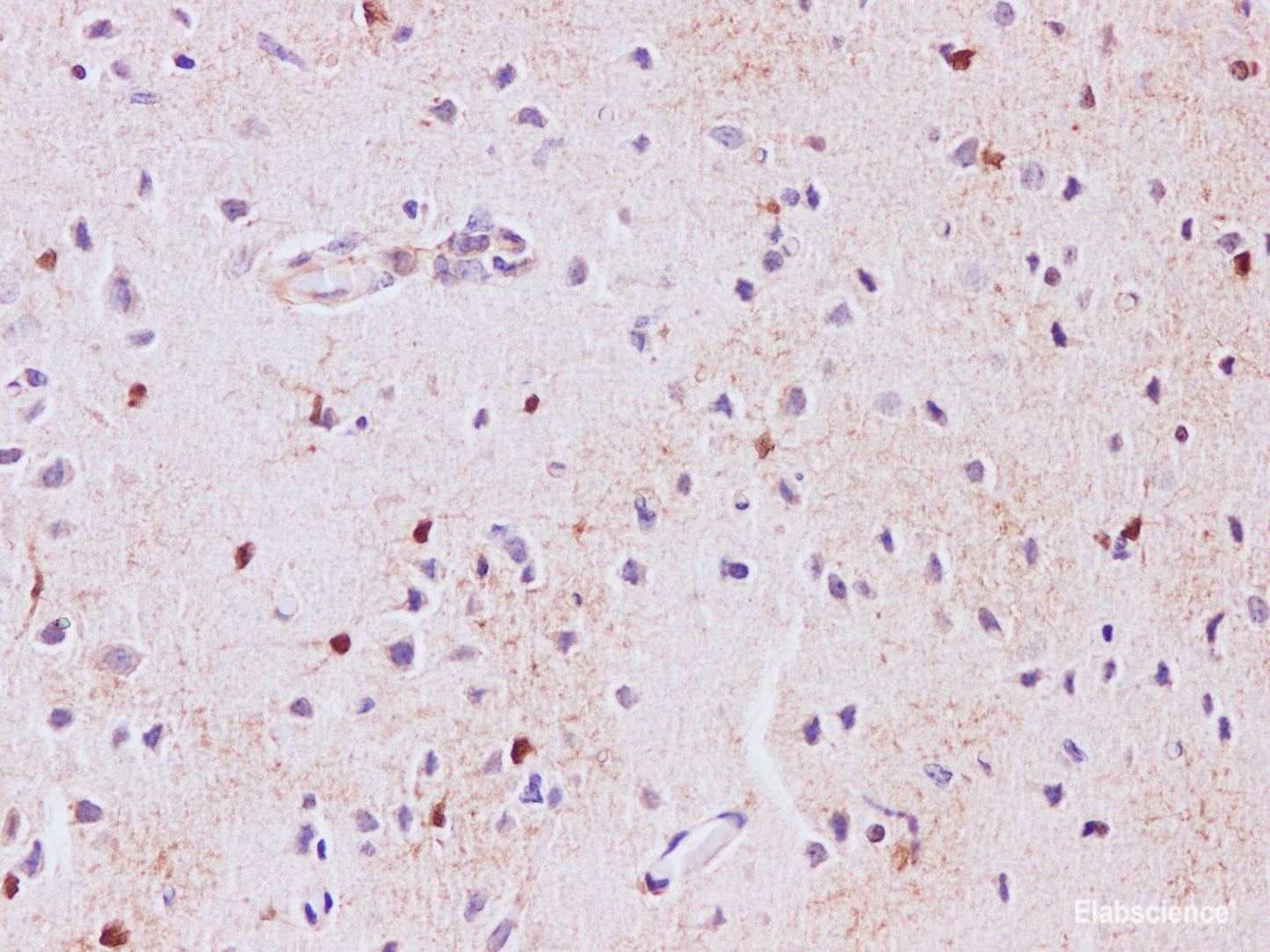 Immunohistochemistry of paraffin-embedded Rat brain using S100b Polyclonal Antibody at dilution of 1:200