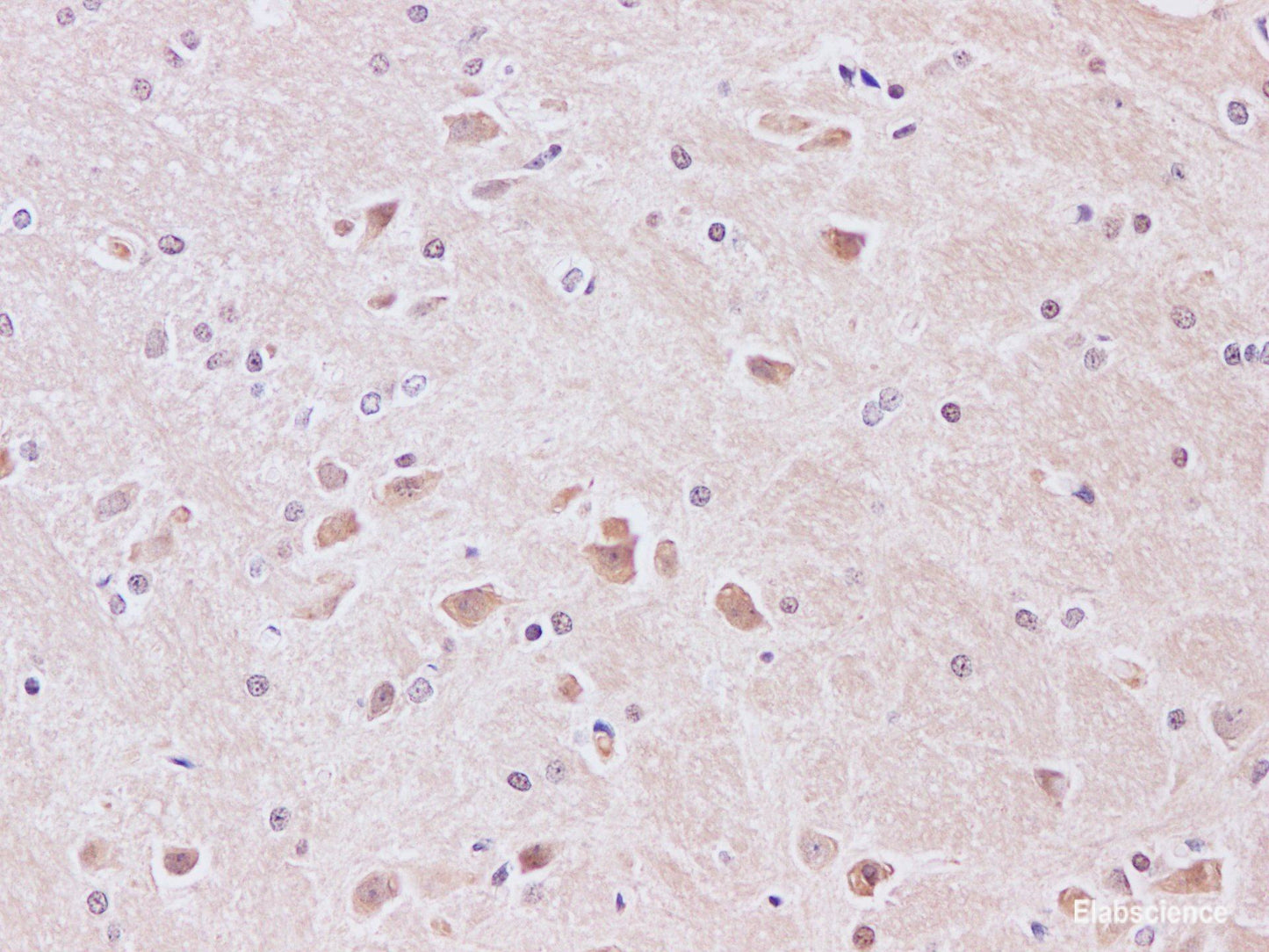 Immunohistochemistry of paraffin-embedded Rat brain using JNK1 Polyclonal Antibody at dilution of 1:200