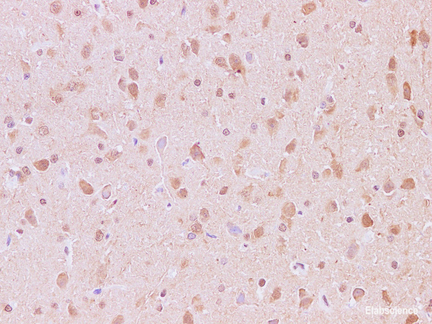 Immunohistochemistry of paraffin-embedded Rat brain using JNK2 Polyclonal Antibody at dilution of 1:200