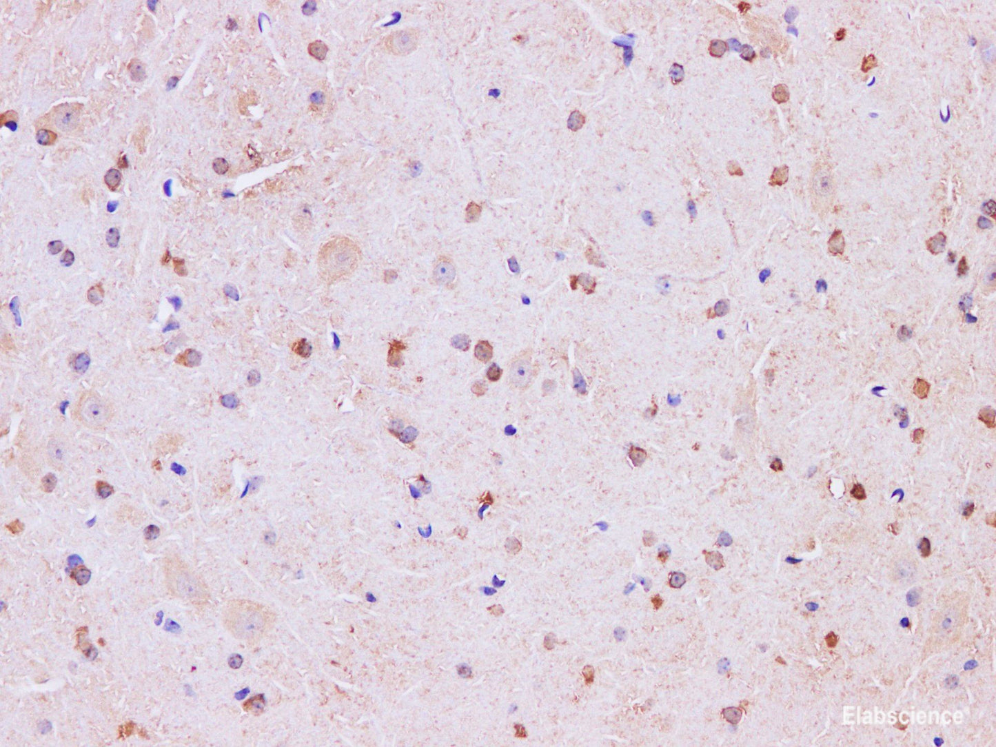 Immunohistochemistry of paraffin-embedded Mouse brain using Mark4 Polyclonal Antibody at dilution of 1:200