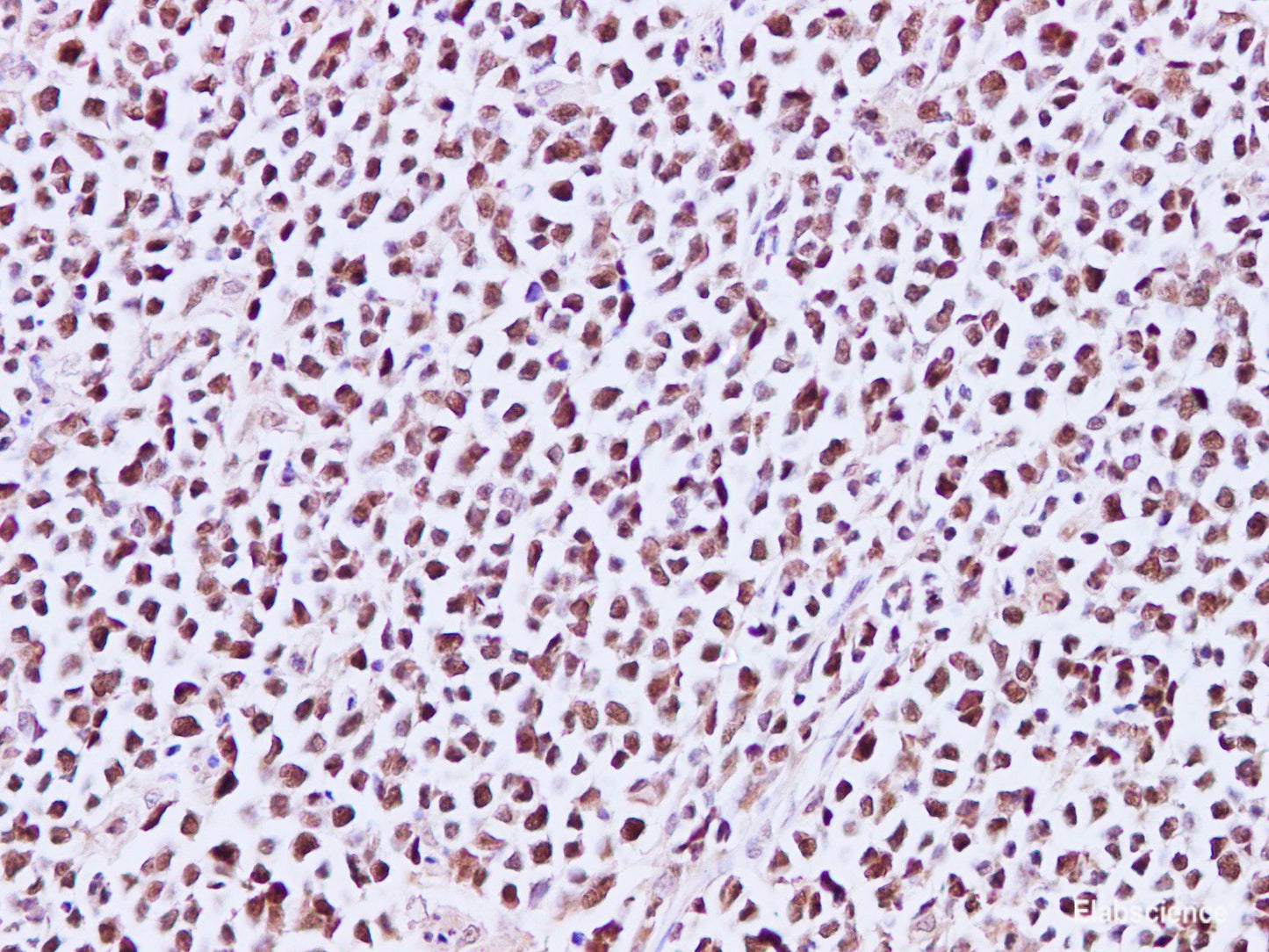Immunohistochemistry of paraffin-embedded Human lymph node using MCM3 Polyclonal Antibody at dilution of 1:200