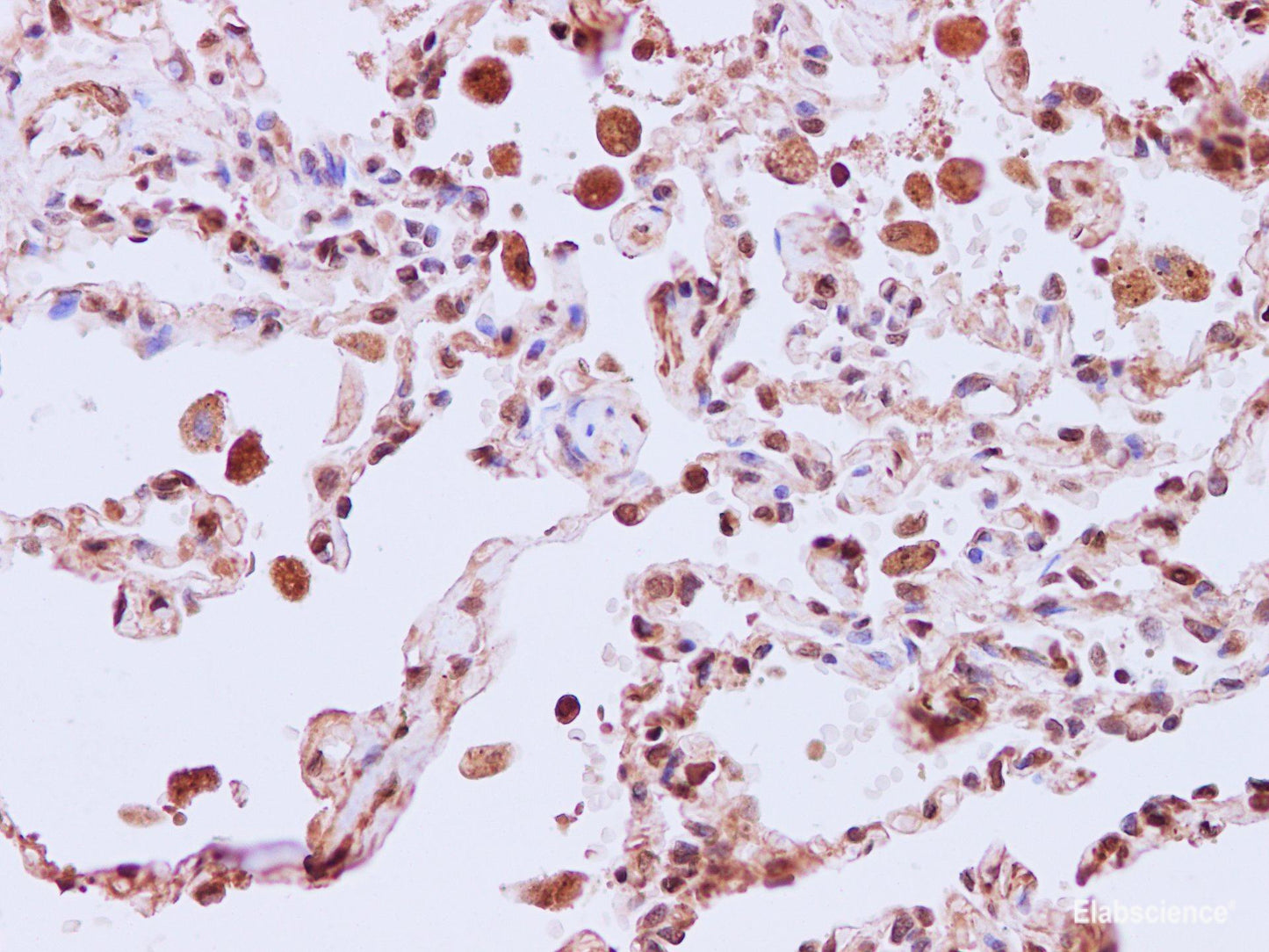 Immunohistochemistry of paraffin-embedded Human lung using ERK8 Polyclonal Antibody at dilution of 1:200