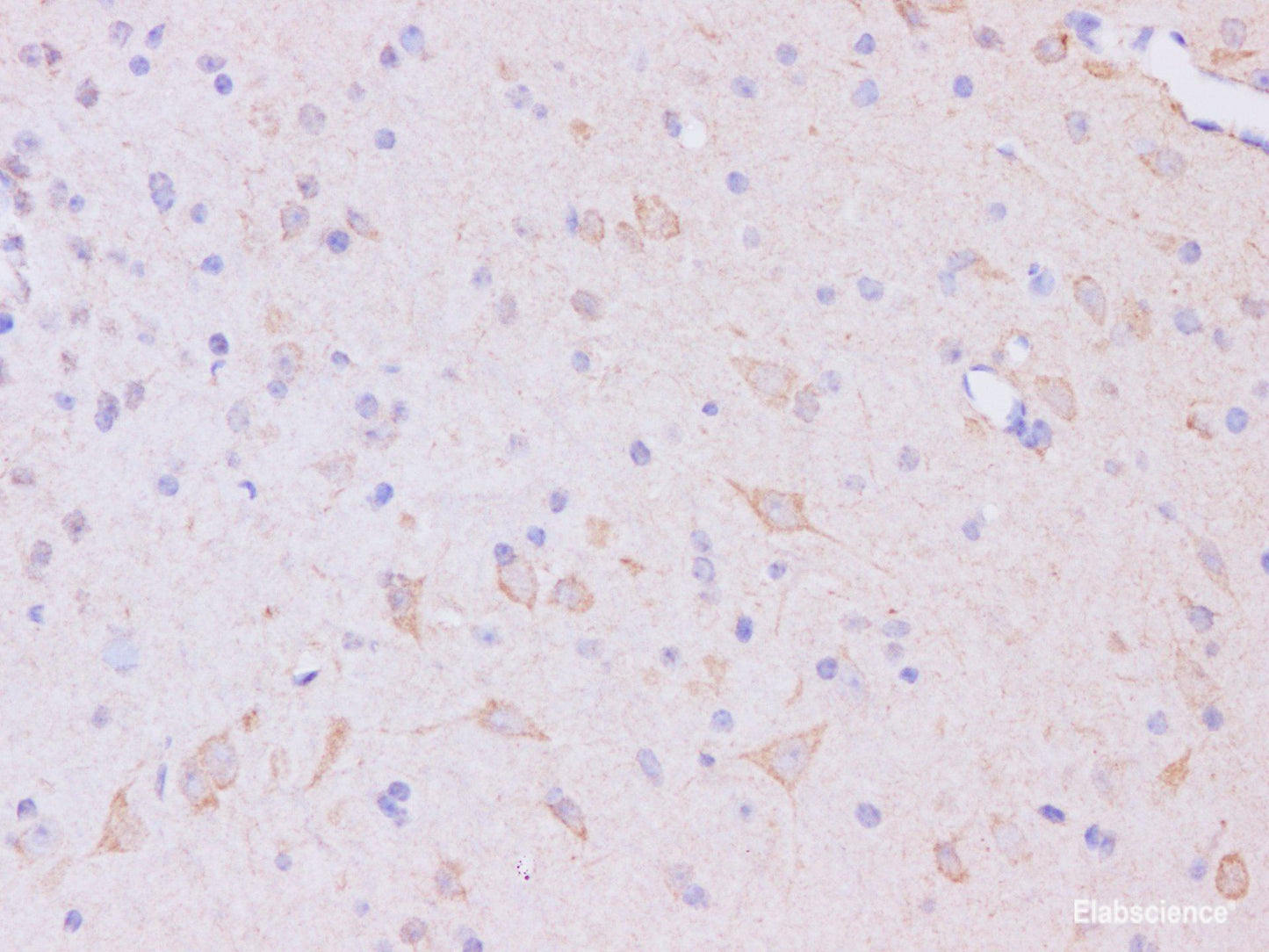Immunohistochemistry of paraffin-embedded Mouse brain using Trim37 Polyclonal Antibody at dilution of 1:200