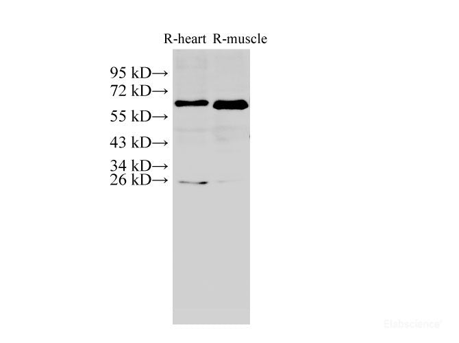 Western Blot analysis of Rat heart and Rat muscle using AMPK alpha2 Polyclonal Antibody at dilution of 1:1000