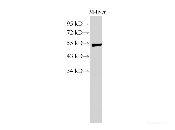 Western Blot analysis of Mouse liver using GCK Polyclonal Antibody at dilution of 1:1000