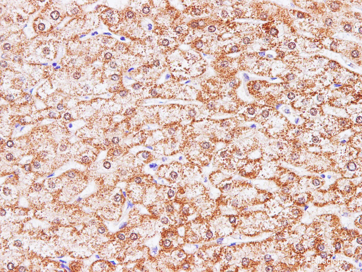 Immunohistochemistry of paraffin-embedded Human liver using CCL2 Polyclonal Antibody at dilution of 1:100