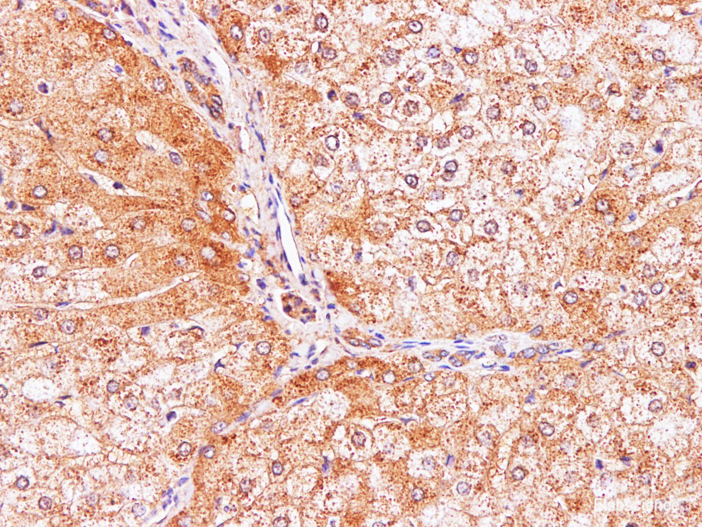 Immunohistochemistry of paraffin-embedded Human liver using IL2 Polyclonal Antibody at dilution of 1:100