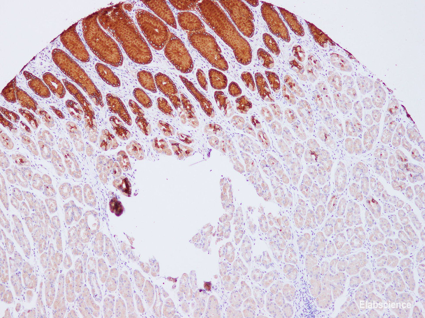 Immunohistochemistry of paraffin-embedded Human stomach using MUC5AC Polyclonal Antibody at dilution of 1:100(100×)
