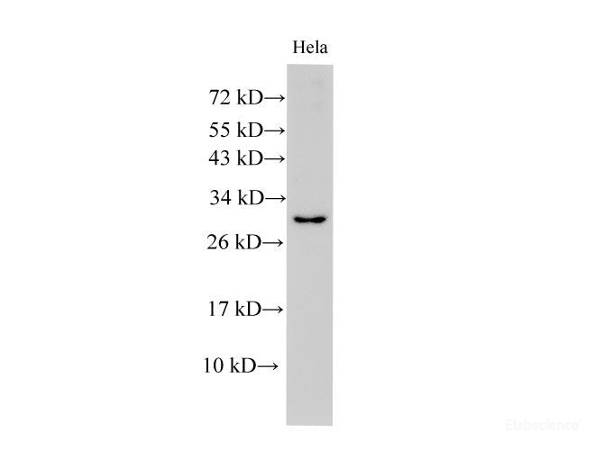 Western Blot analysis of Hela cells using CRP Polyclonal Antibody at dilution of 1:1000