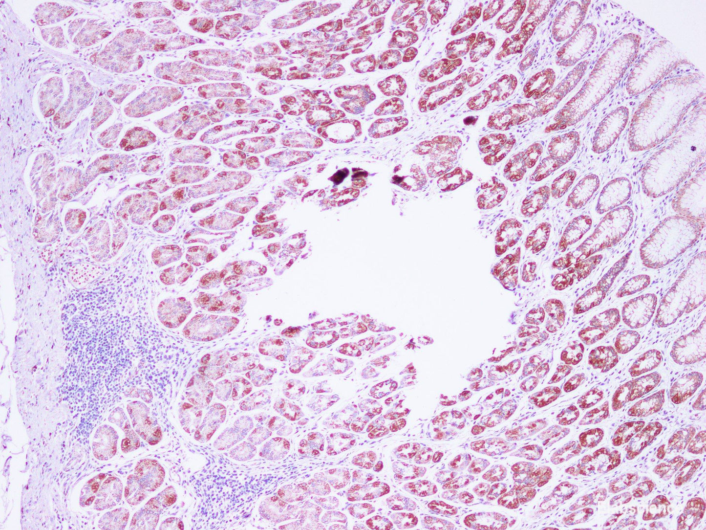 Immunohistochemistry of paraffin-embedded Human stomach using IHH Polyclonal Antibody at dilution of 1:100(100×)