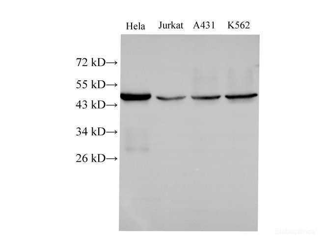 Western Blot analysis of Hela, Jurkat, A431 and k562 cells using CK-18 Polyclonal Antibody at dilution of 1:500