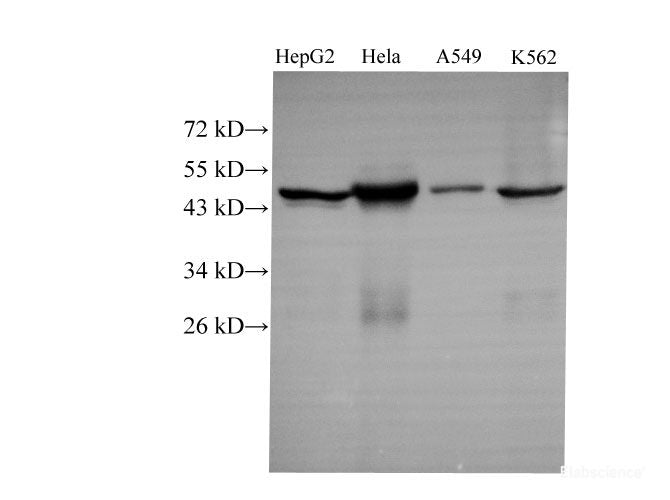 Western Blot analysis of HepG2, Hela, A549 and k562 using CK-18 Polyclonal Antibody at dilution of 1:1000