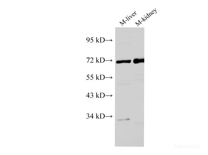 Western Blot analysis of Mouse liver and Mouse kidney using AFP Polyclonl Antibody at dilution of 1:1000.