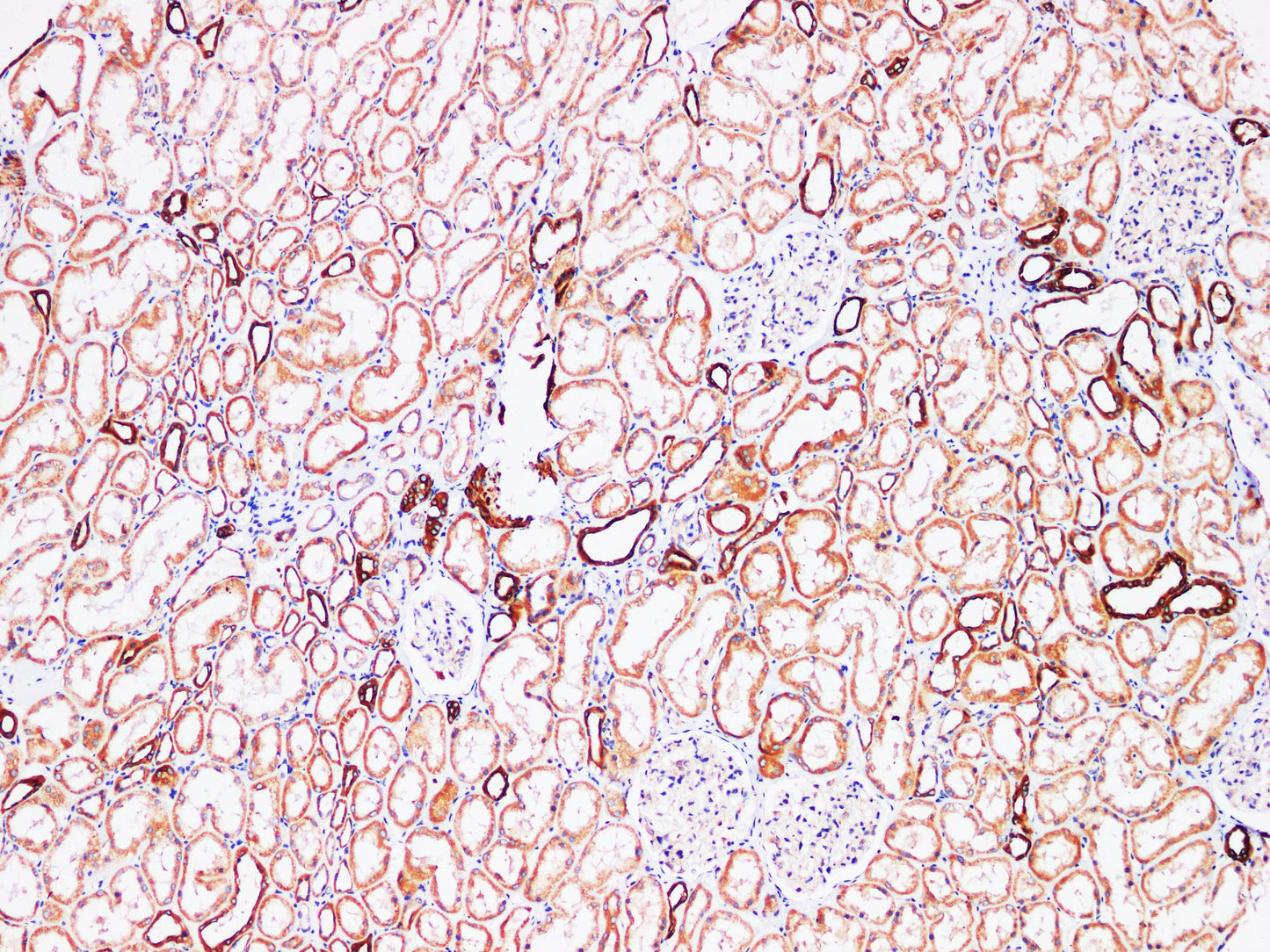 Immunohistochemistry of paraffin-embedded Human kidney using FUT3 Polyclonl Antibody at dilution of 1:200.