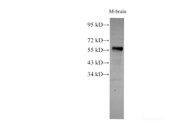 Western Blot analysis of Mouse brain using AKT1S1 Polyclonl Antibody at dilution of 1:2000.