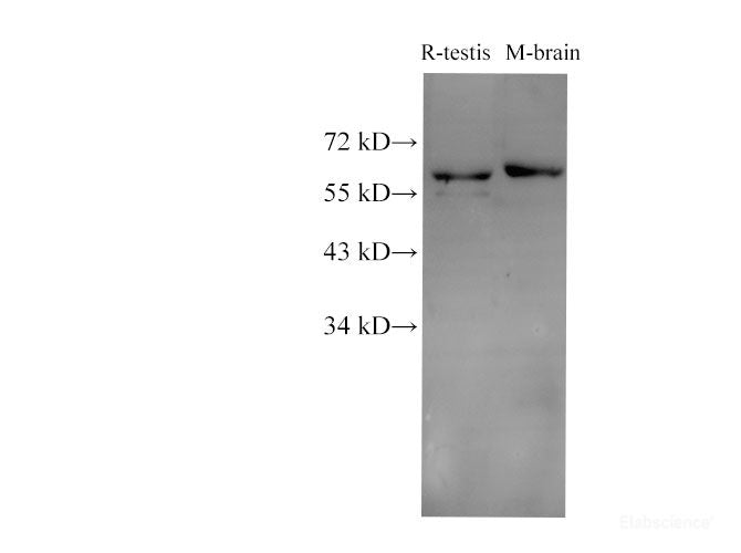 Western Blot analysis of Rat testis and Mouse brain using c-SRC Polyclonl Antibody at dilution of 1:1000.