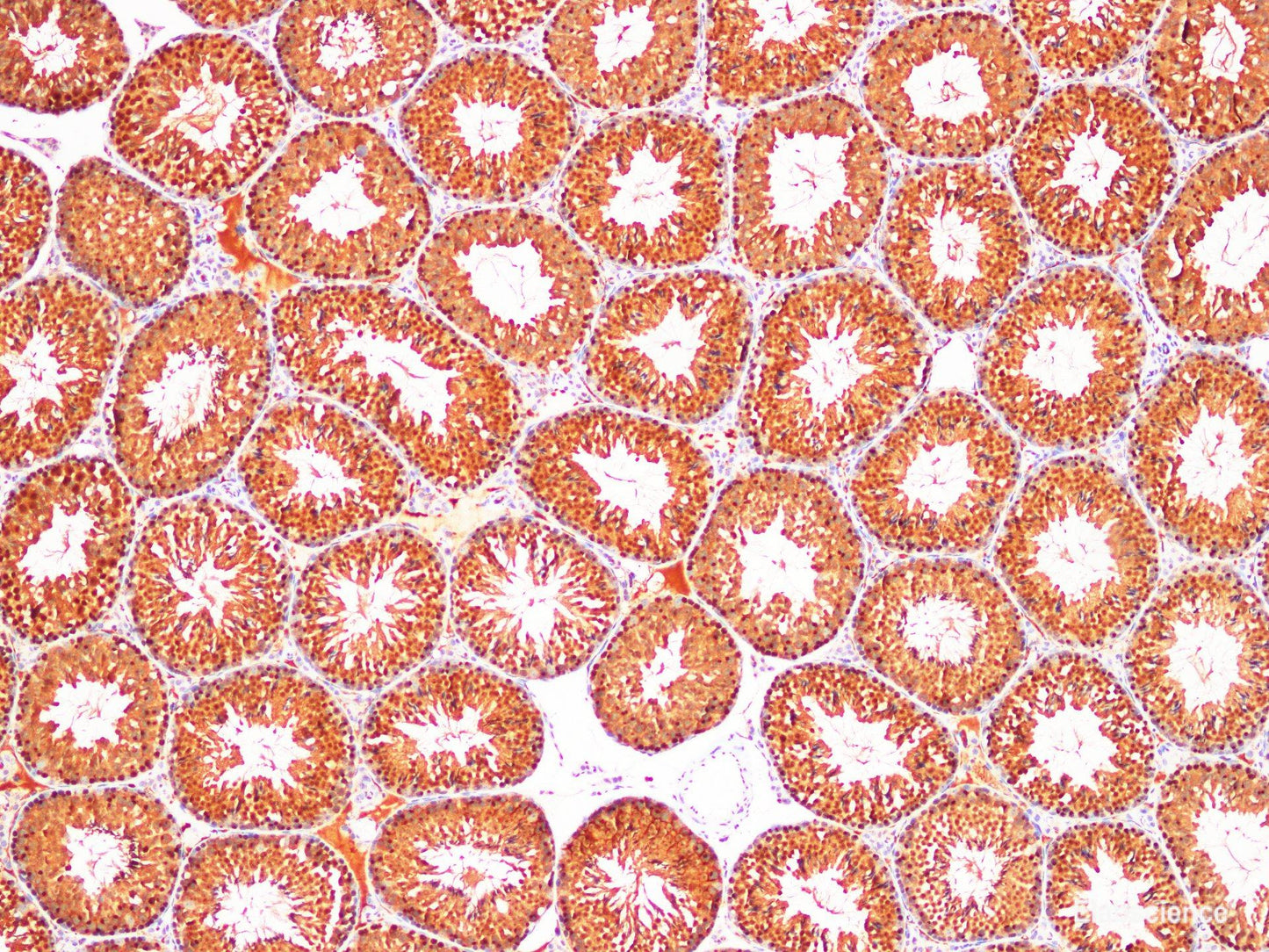 Immunohistochemistry of paraffin-embedded Mouse testis using DNMT1 Polyclonl Antibody at dilution of 1:200(100×).