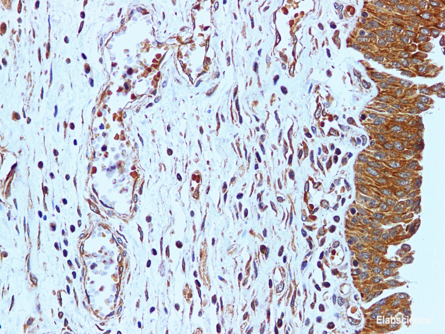 Immunohistochemistry of paraffin-embedded Human urinary bladder using AKT1 Polyclonal Antibody at dilution of 1:100
