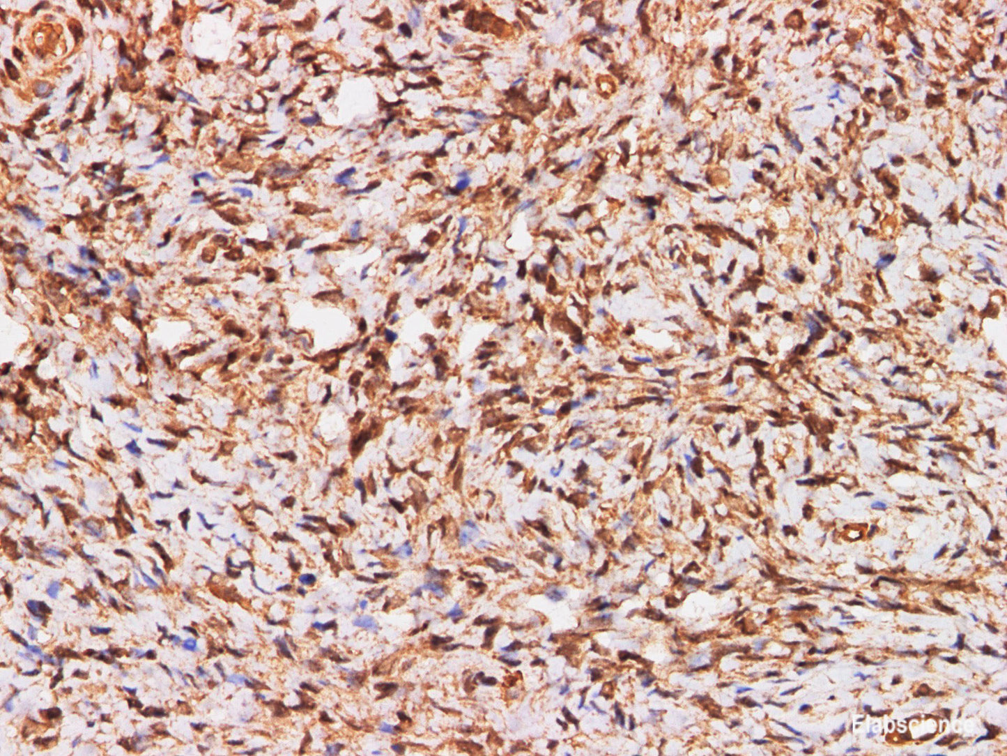 Immunohistochemistry of paraffin-embedded Human ovary using S100A11 Polyclonal Antibody at dilution of 1:200