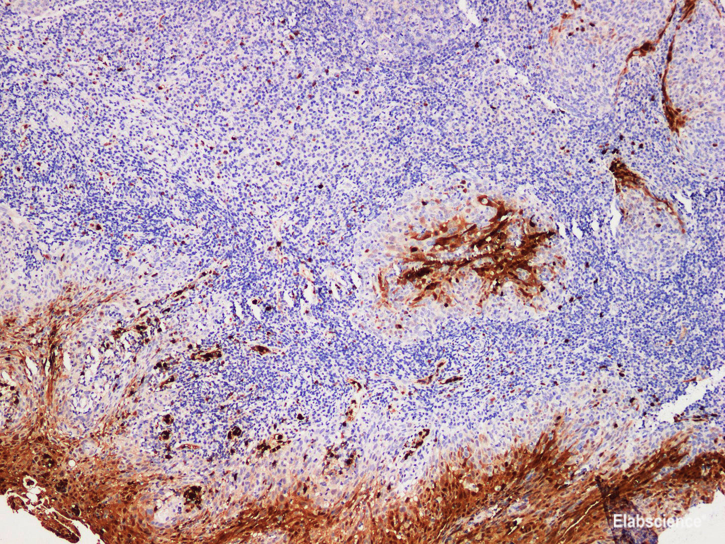 Immunohistochemistry of paraffin-embedded Human tonsil using S100P Polyclonal Antibody at dilution of 1:200