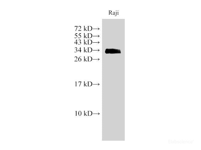 Western Blot analysis of Raji cell using CD74 Polyclonal Antibody at dilution of 1:1000