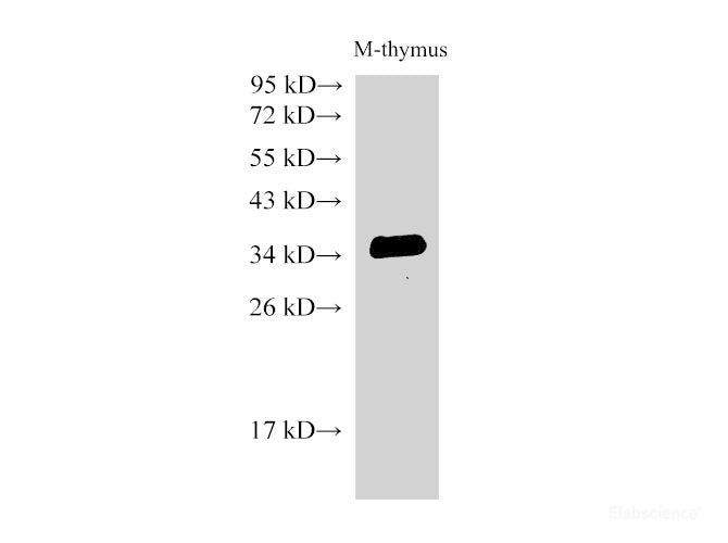 Western Blot analysis of Mouse thymus using CD74 Polyclonal Antibody at dilution of 1:500