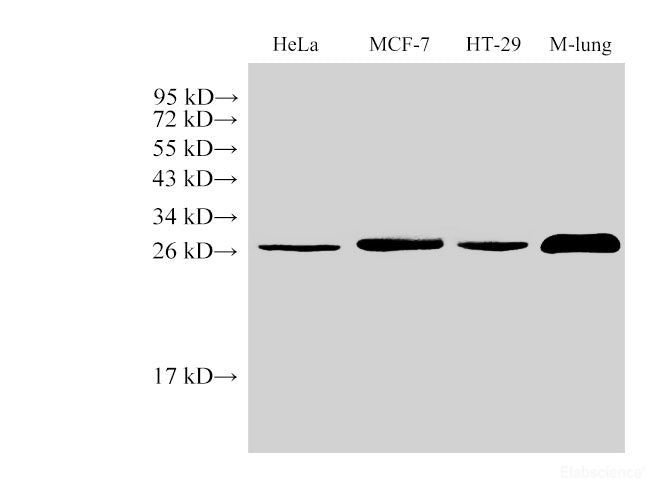 Western Blot analysis of 1)Hela, 2)MCF-7, 3)HT-29, 4)Mouse Lung using LGALS3 Polycloanl Antibody at dilution of 1:1000