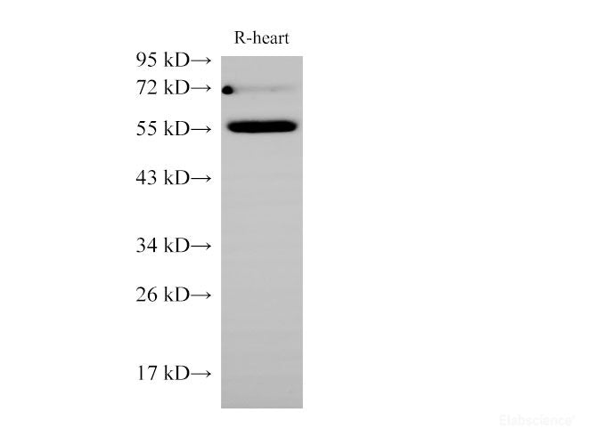 Western Blot analysis of Rat Heart using Ceacam1 Polycloanl Antibody at dilution of 1:1000