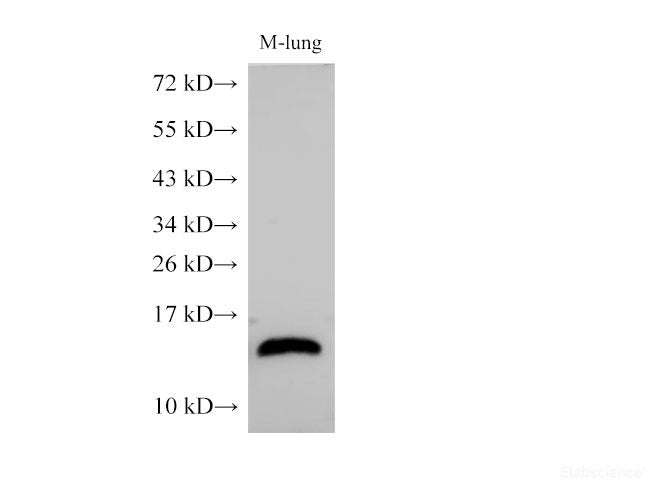 Western Blot analysis of Mouse lung using B2M Polycloanl Antibody at dilution of 1:1000