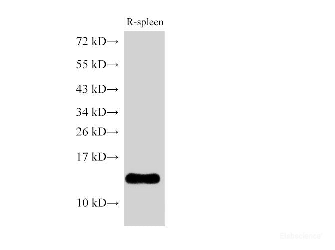 Western Blot analysis of Rat spleen using B2M Polycloanl Antibody at dilution of 1:500