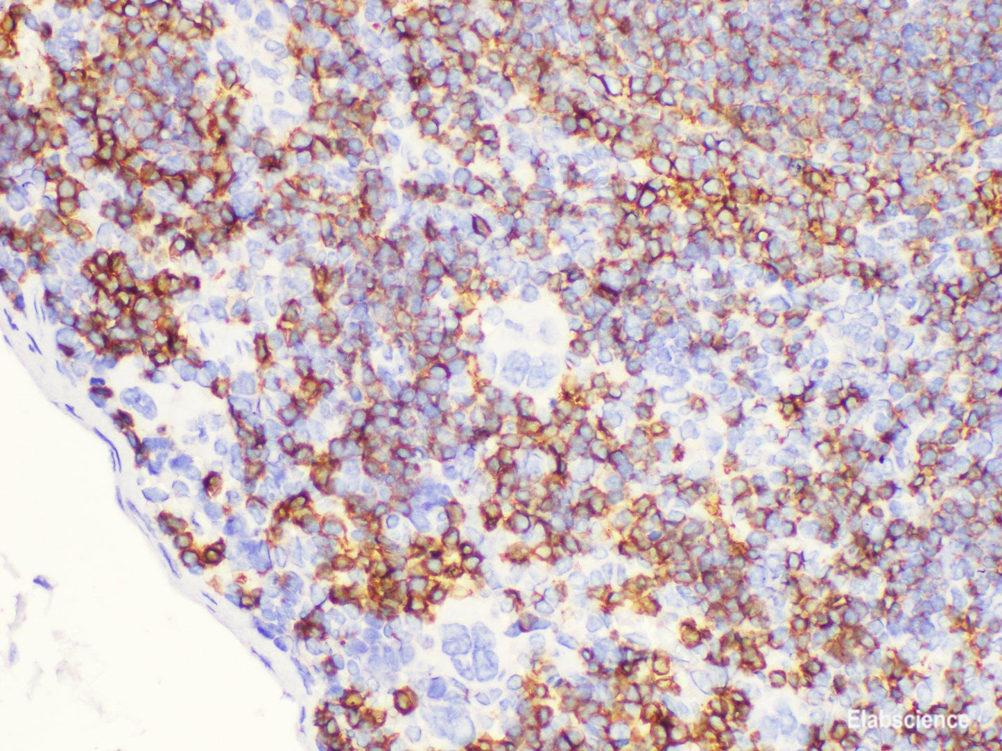 Immunohistochemistry of paraffin-embedded Mouse spleen using CD20 Polycloanl Antibody at dilution of 1:100