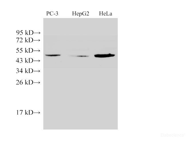 Western Blot analysis of 1)PC-3, 2)HepG2, 3)Hela using PSAP Ployclonal Antibody at dilution of 1:500.