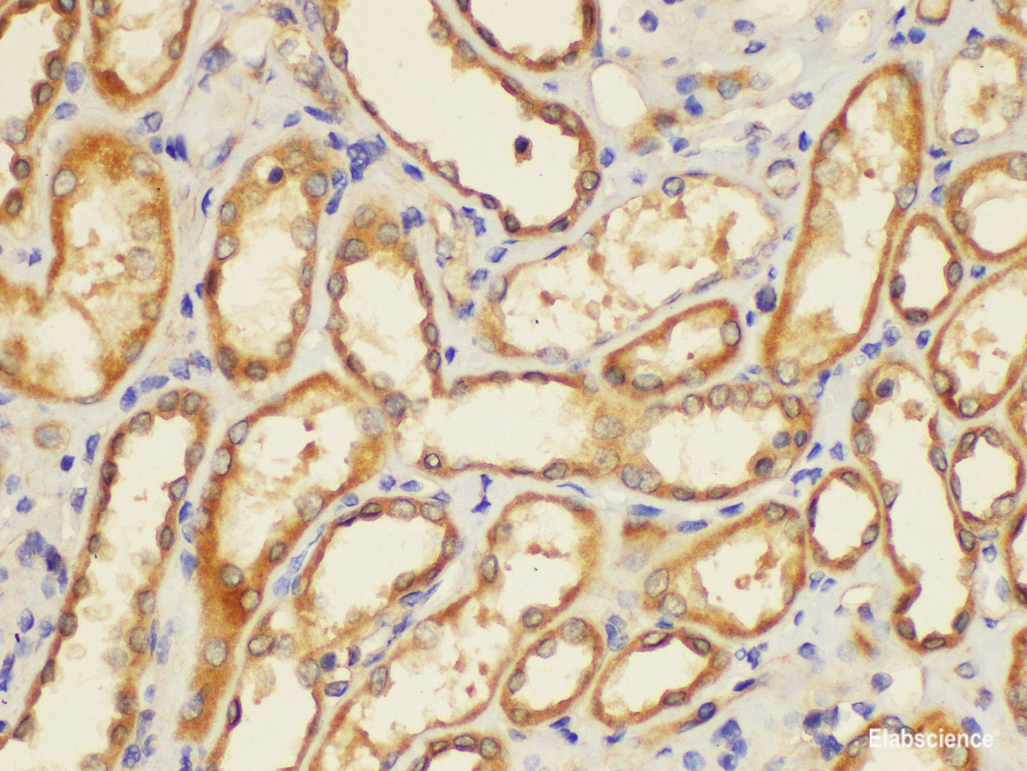 Immunohistochemistry of paraffin-embedded Human kidney using ST14 Ployclonal Antibody at dilution of 1:200.