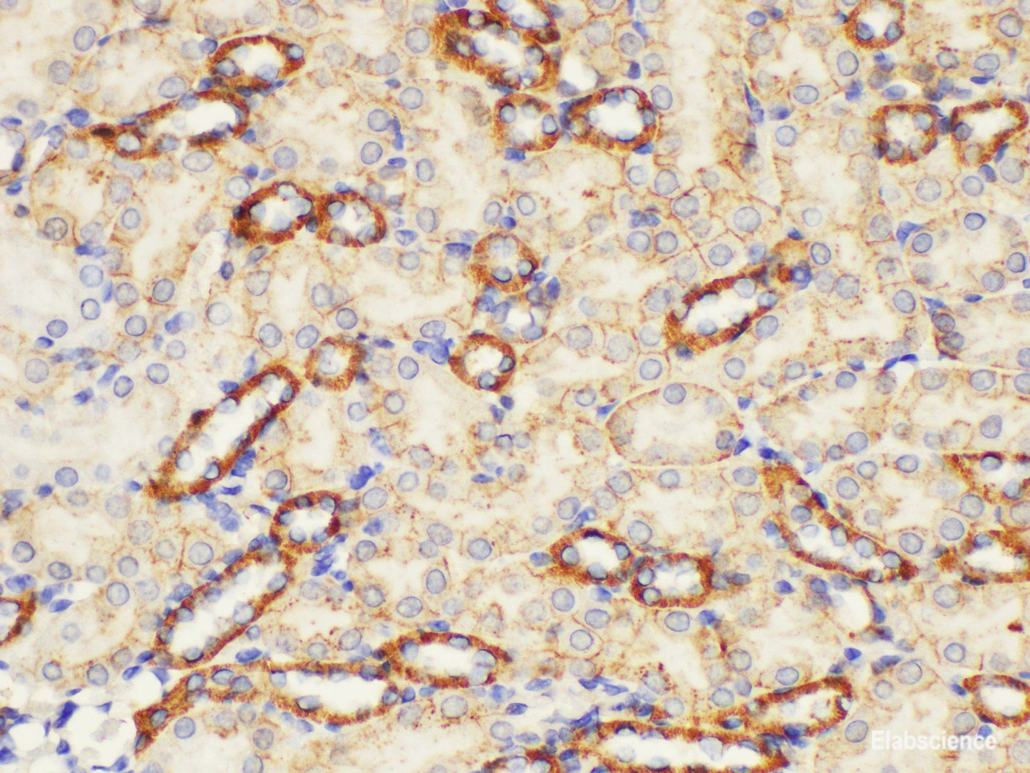 Immunohistochemistry of paraffin-embedded Mouse kidney using ST14 Ployclonal Antibody at dilution of 1:200.