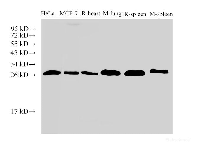 Western Blot analysis of 1)Hela, 2)MCF-7, 3)Rat heart, 4)Mouse lung, 5)Rat spleen, 6)Mouse spleen using Galectin 3 Ployclonal Antibody at dilution of 1:500.