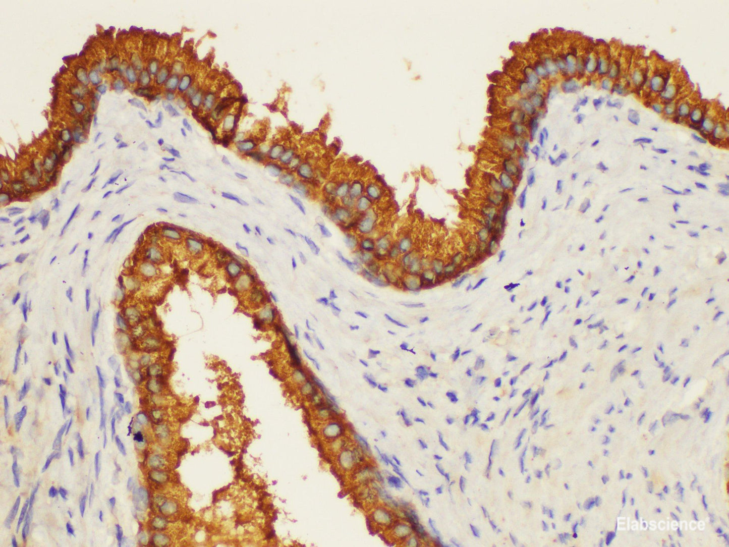 Immunohistochemistry of paraffin-embedded Human prostate using PSAP Ployclonal Antibody at dilution of 1:50.
