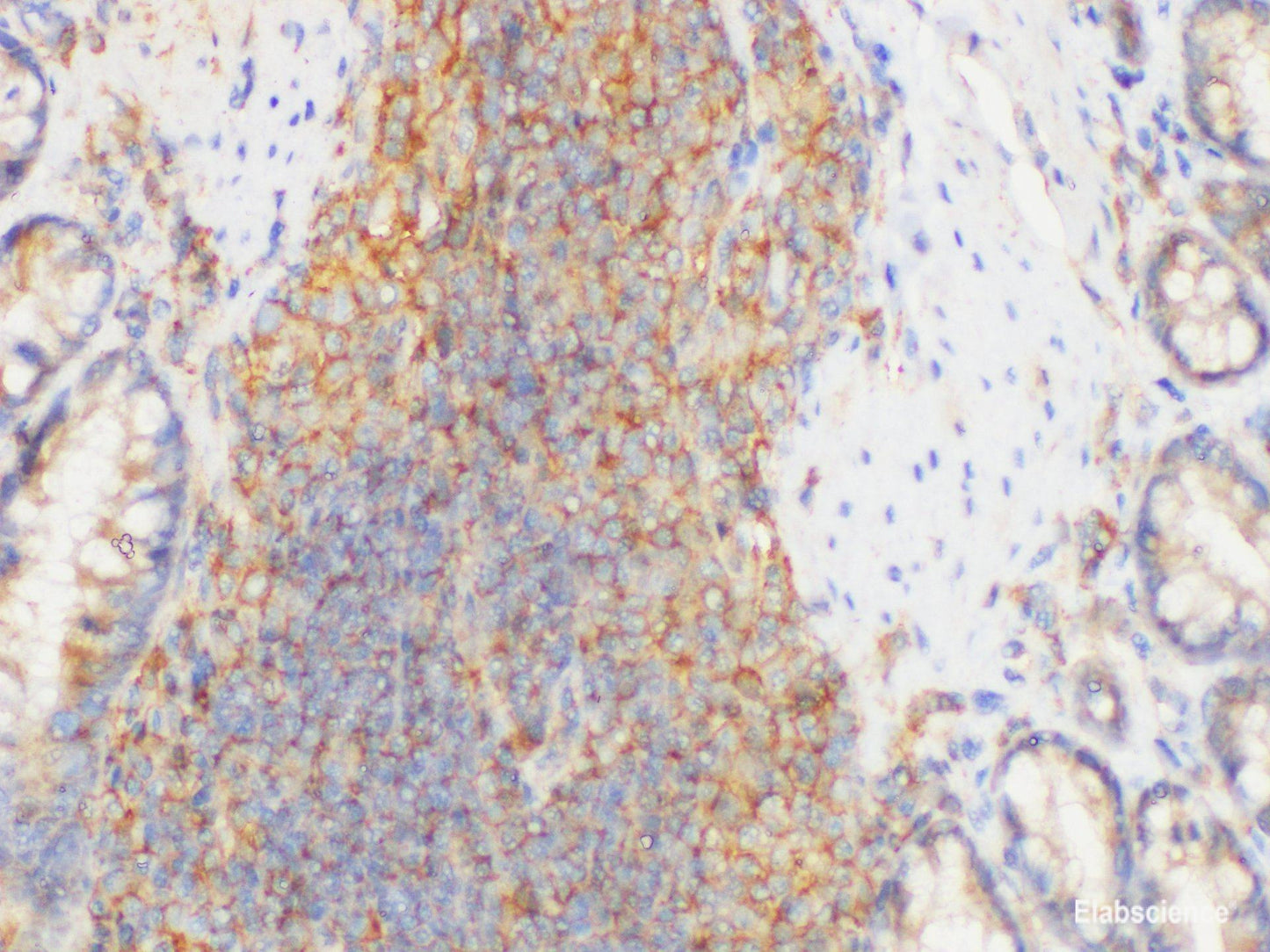 Immunohistochemistry of paraffin-embedded Rat Lymphoid nodule using IL1A Polycloanl Antibody at dilution of 1:200