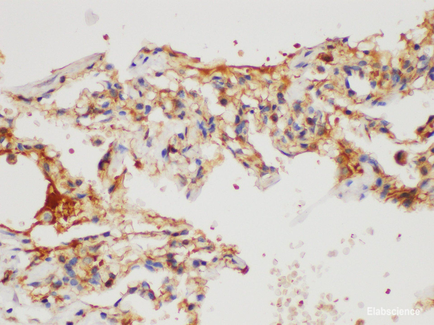 Immunohistochemistry of paraffin-embedded Human lung using CD109 Polycloanl Antibody at dilution of 1:200