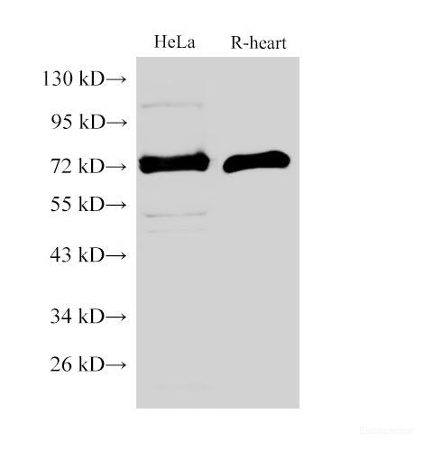 Western Blot analysis of Hela and Rat heart using MMP2 Polyclonal Antibody at dilution of 1:500