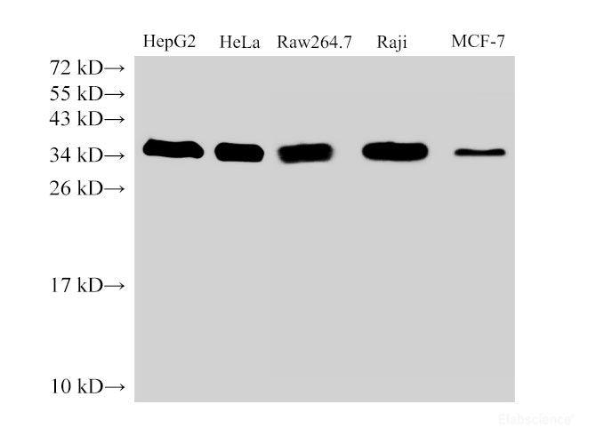 Western Blot analysis of HepG2, Hela, Raw264.7 Raji and MCF-7 cells using PCNA Polyclonal Antibody at dilution of 1:500